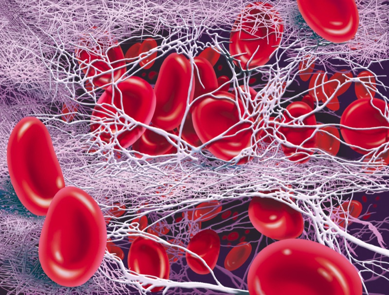 Blutgerinnung — illustrazione medica di Walter Pepperle, Francoforte sul Meno