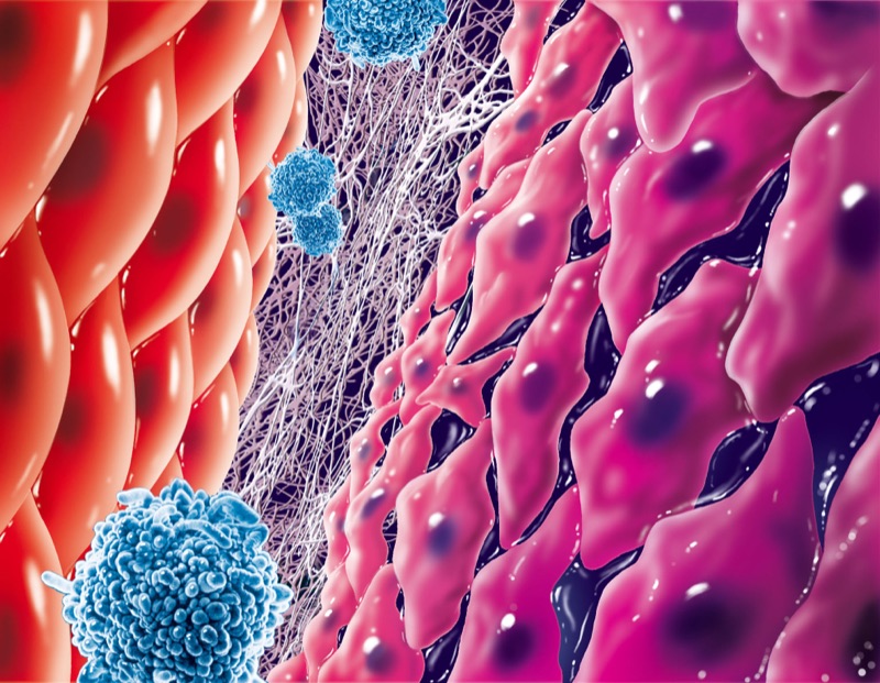 Tumor Grenzregion — illustrazione medica di Walter Pepperle, Francoforte sul Meno